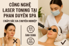 GIẢI PHÁP ĐIỀU TRỊ NÁM TẬN GỐC BẰNG CÔNG NGHỆ LASER TONING – PHÙ HỢP CHO PHỤ NỮ SAU SINH