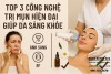 TOP 3 CÔNG NGHỆ TRỊ MỤN HIỆN ĐẠI GIÚP DA SÁNG KHỎE TẠI CÁC SPA UY TÍN VÙNG VEN TP.HCM