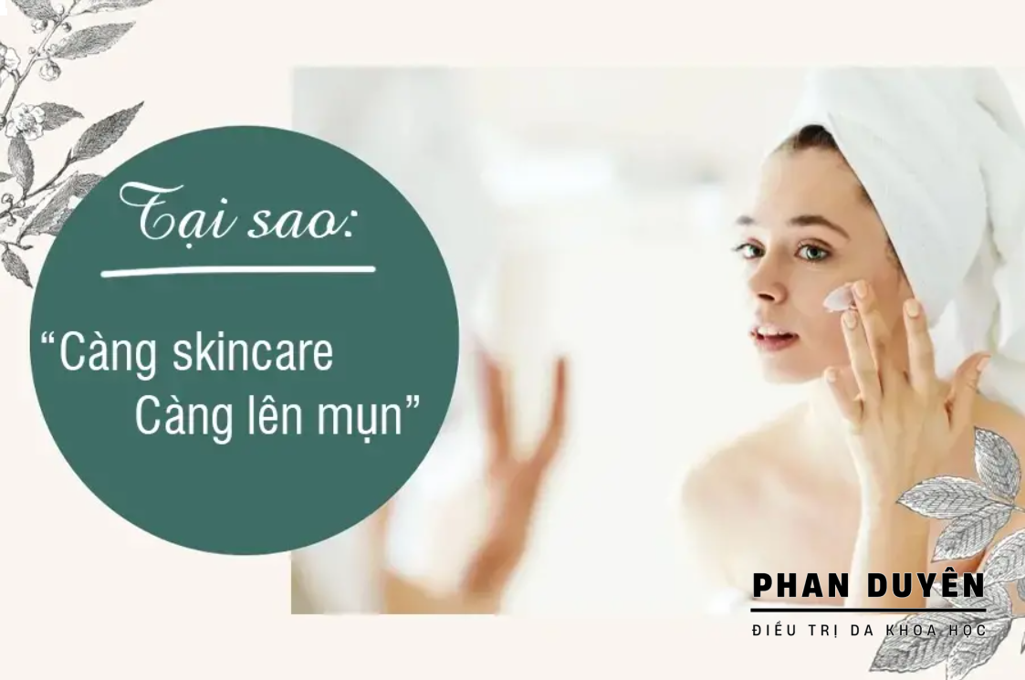 VÌ SAO BẠN CÀNG SKINCARE CÀNG LÊN MỤN ?