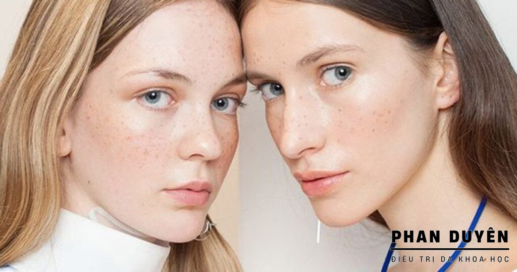 NÁM DI TRUYỀN CÓ TRỊ ĐƯỢC KHÔNG? HAY PHẢI SỐNG CHUNG SUỐT ĐỜI?