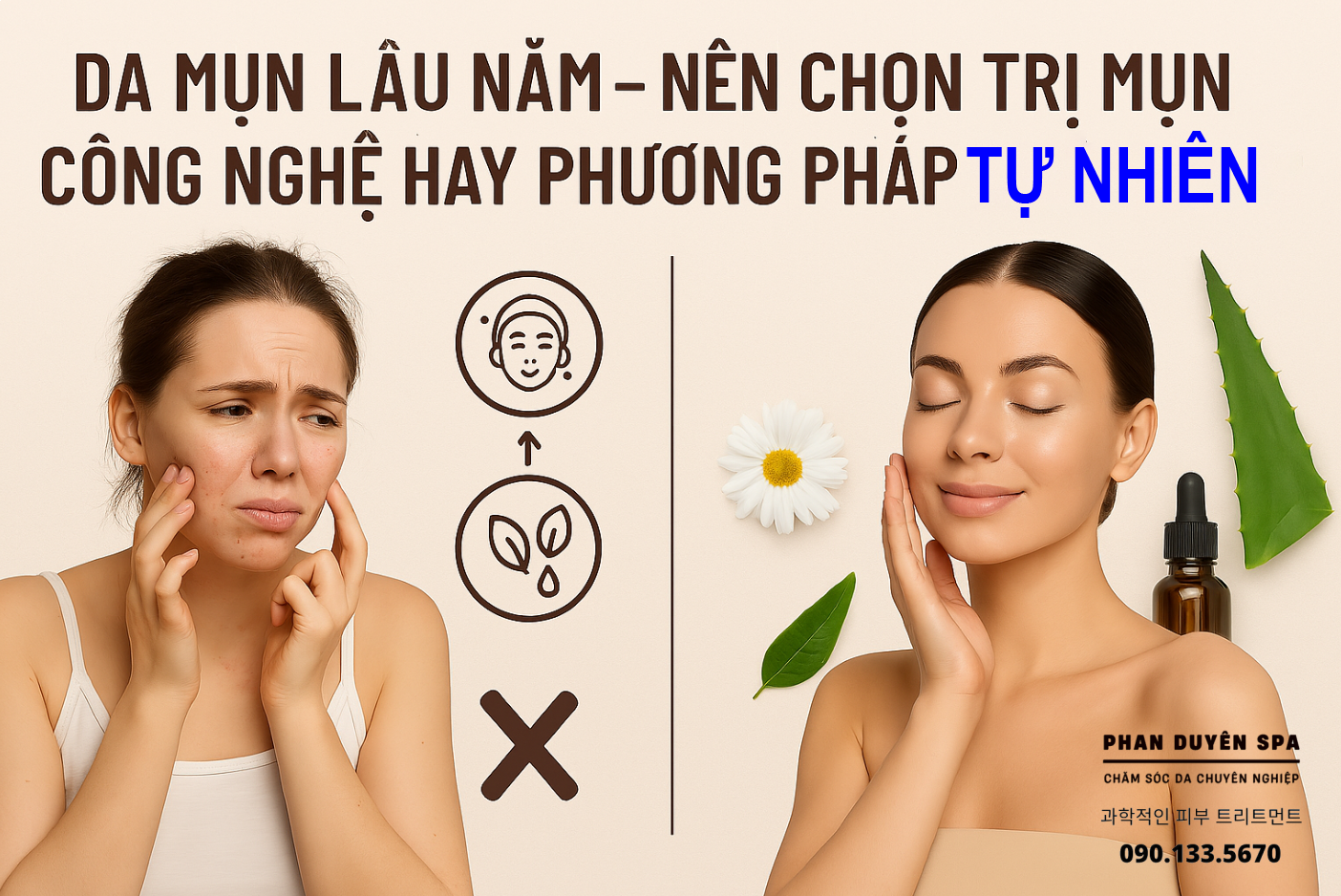 DA MỤN LÂU NĂM – NÊN CHỌN TRỊ MỤN CÔNG NGHỆ HAY PHƯƠNG PHÁP THIÊN NHIÊN?